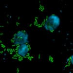 Amöbe und Pseudomonas